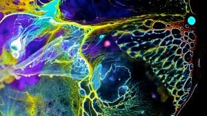 ضرر ارتفاع تكاليف الأمراض النادرة