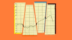 منظور النتائج قصيرة الأجل