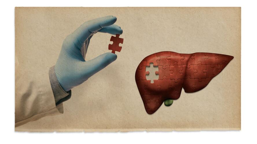 أمراض الكبد
