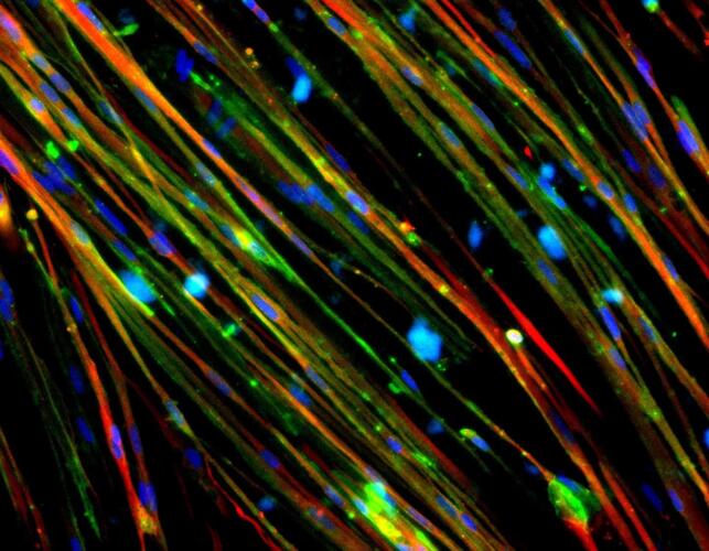 كيف يساعد تخطيط الخلايا البشرية في الكشف عن أسباب بعض الأمراض العضلية؟