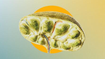 ما هي أسباب تضخم العقد اللمفاوية؟ ومتى يكون خطيراً؟