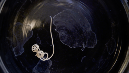 سيحدث للطبيعة والإنسان إذا انقرضت الطفيليات