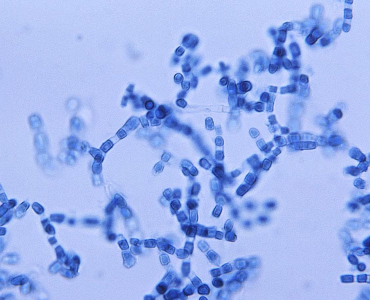 حمى الوادي المتصدع, أمراض, فطريات, صحة, بيئة, التغير المناخي