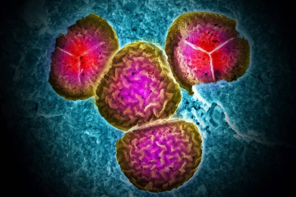 أحافير الغابات المطيرة