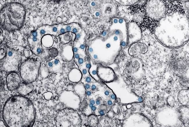 فيروس كورونا