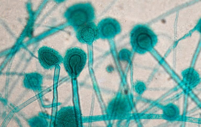 ما أعراض الإصابة بداء الرشاشيات وكيف تحمي نفسك منه؟