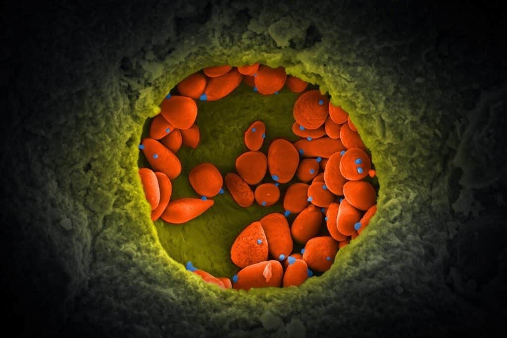 أحافير الغابات المطيرة