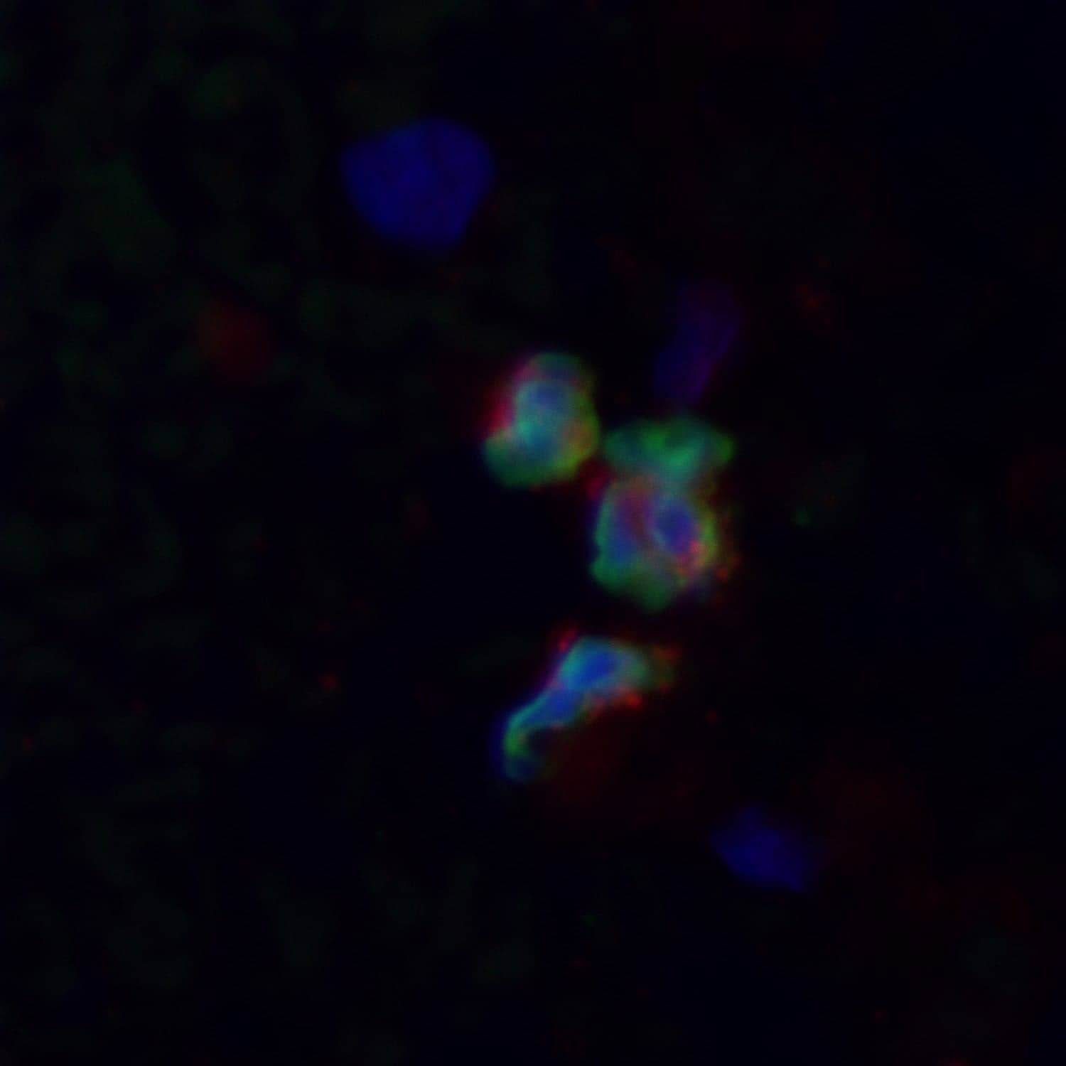 عينة دموية من رئة دب بنيّ تحت المجهر. الأستاذ أوليه فروبرت (Ole Frobert) والأستاذ توبياس بيتزولد (Tobias Petzold).