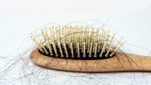 ما طرق علاج تساقط الشعر بعد الولادة؟