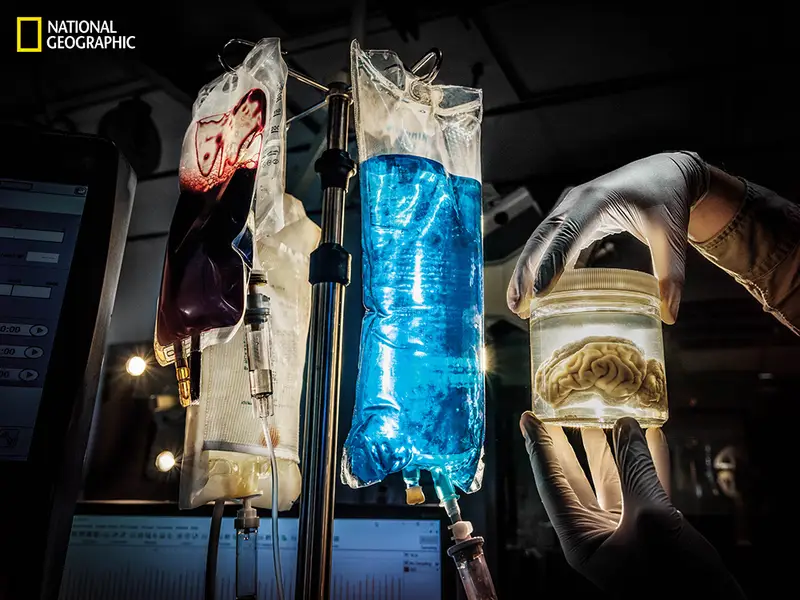 بحث علماء من جامعة ييل عن طريقة لإعادة إحياء أنسجة الدماغ الميتة حديثاً بهدف التوصل لفهم أعمق للطريقة التي تتواصل وفقها الخلايا من منطقة دماغية محددة مع الخلايا في مناطق أخرى. نجح الفريق في ذلك عند دراسة دماغ خنزير من خلال المزج بين مجموعة من الأدوية المخصصة (باللون الأزرق) وحامل للأوكسجين (باللون الأحمر الداكن). (حقوق الصورة: ناشيونال جيوغرافيك (ماكس أغيوليرا-هيلويغ)