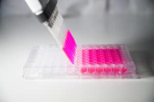 كورونا حول العالم