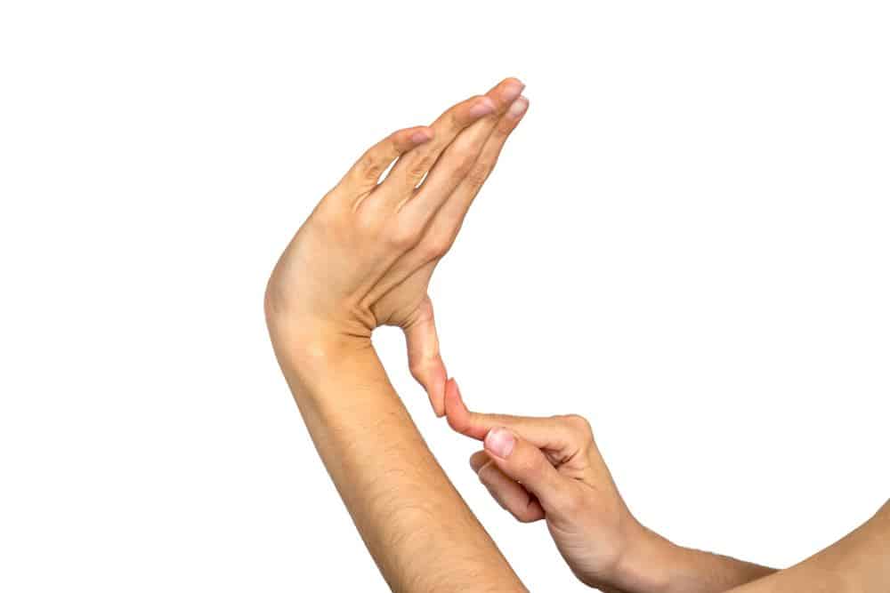 متلازمة مارفان