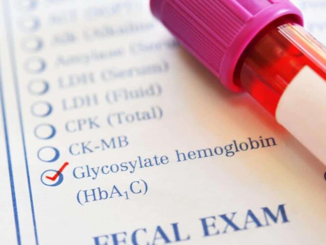 ما هو النظام الغذائي الملائم لمرضى السكر التراكمي؟