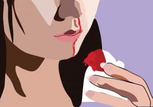 هل ينصح بوضع الثلج على الأنف عند الرعاف؟