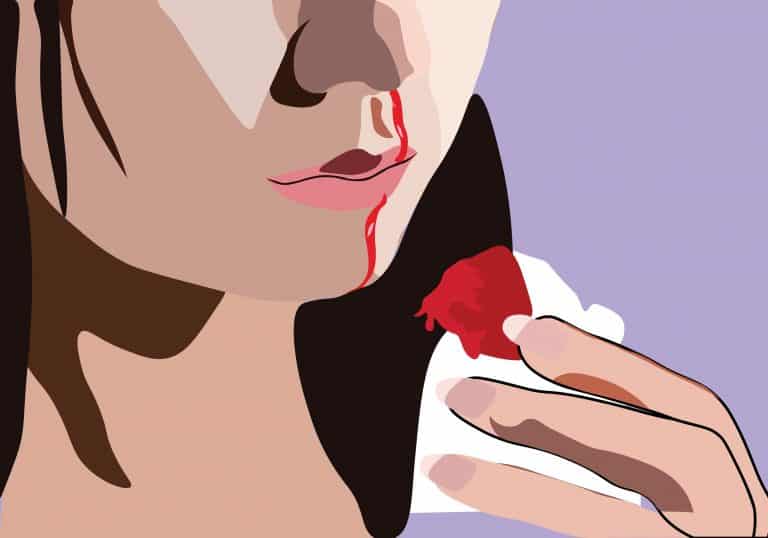 هل ينصح بوضع الثلج على الأنف عند الرعاف؟