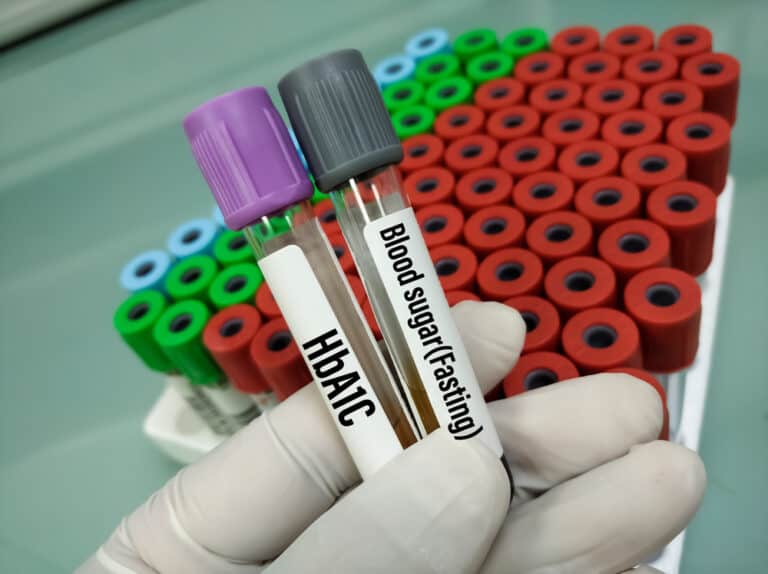 فحص السكر