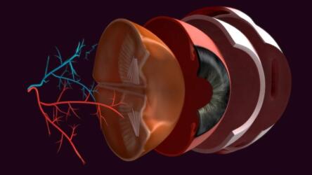 ما هي عملية إزالة الجسم الزجاجي للعين؟ وما هي إيجابيات هذه العملية وسلبياتها؟