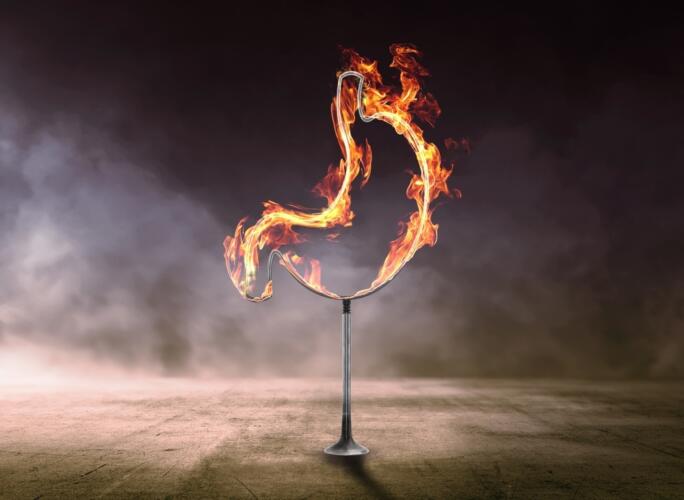 كيف تتخلص من حرقة المعدة في أثناء صيام رمضان؟