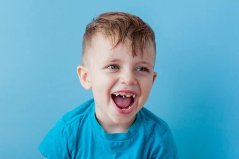 تسوس أسنان الأطفال