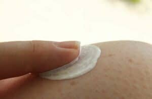 أسباب تهيج الجلد