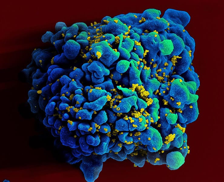 إيدز, مرض الإيدز, التوعية ضد مرض الإيدز, اليوم العالمي للإيدز, أمراض, صحة