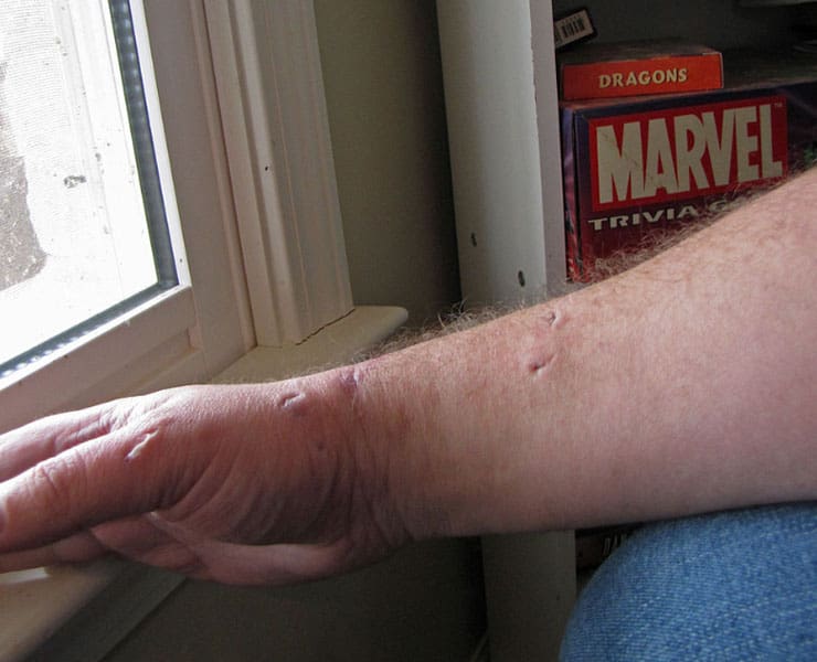 عضات الحيوانات الأليفة, قطة, عضات, فم, تثاؤب