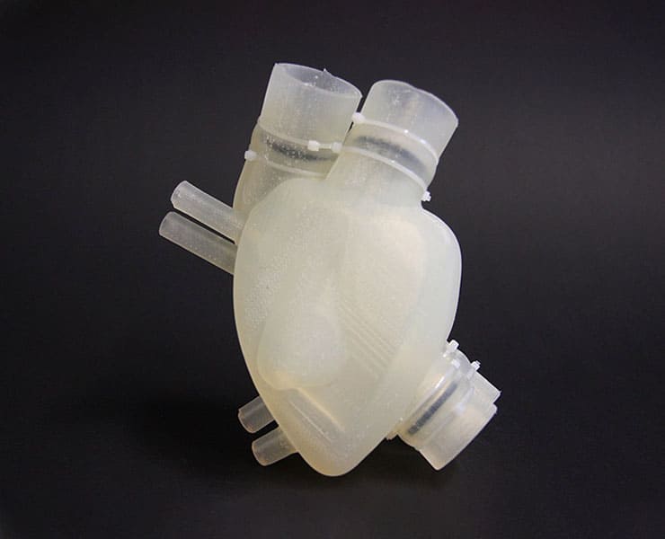 القلب الصناعي, طب, علوم, صحة, القلب, أمراض القلب