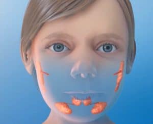 اللعاب, فم, أفواه, طب الأسنان, أطفال